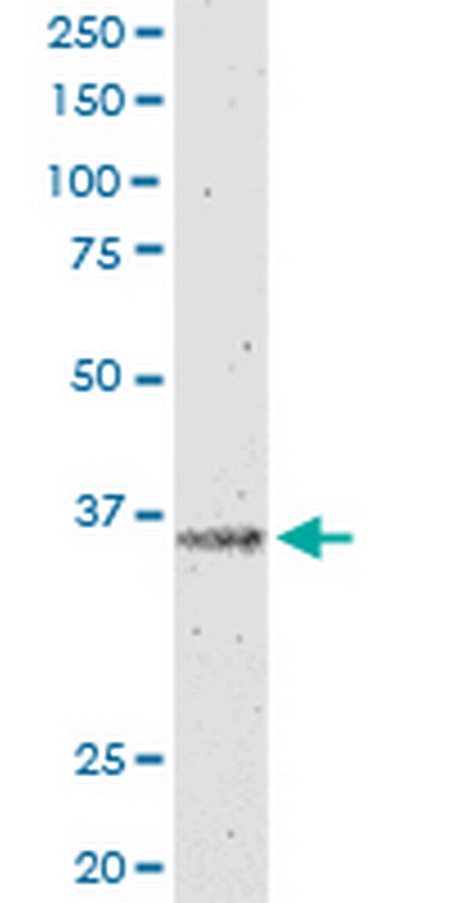 IL12B Antibody in Western Blot (WB)