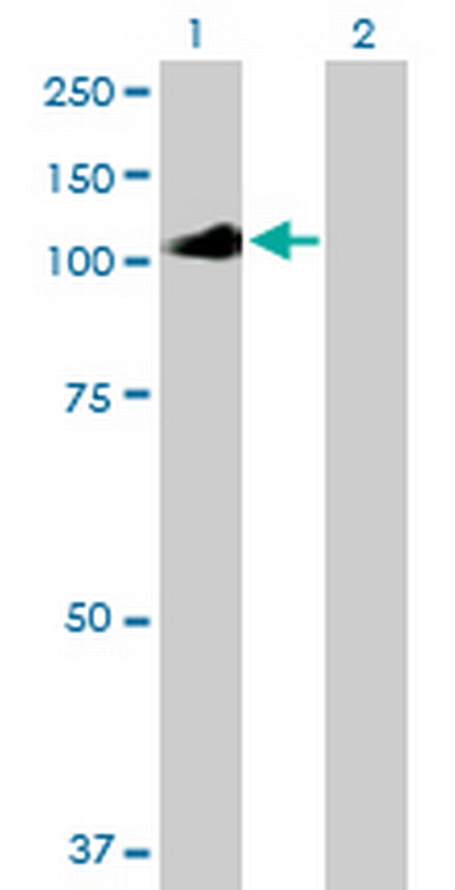 IL12RB2 Antibody in Western Blot (WB)