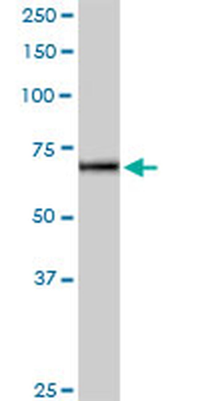 IL12RB2 Antibody in Western Blot (WB)