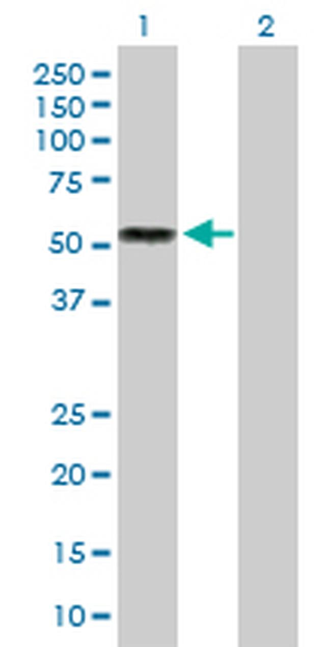 IL13RA2 Antibody in Western Blot (WB)