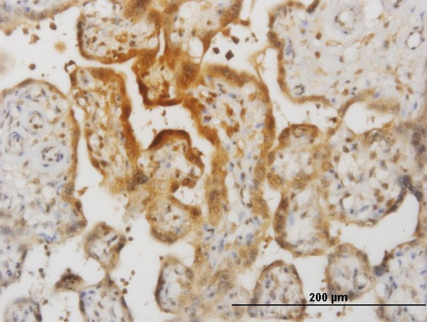 IL15 Antibody in Immunohistochemistry (Paraffin) (IHC (P))