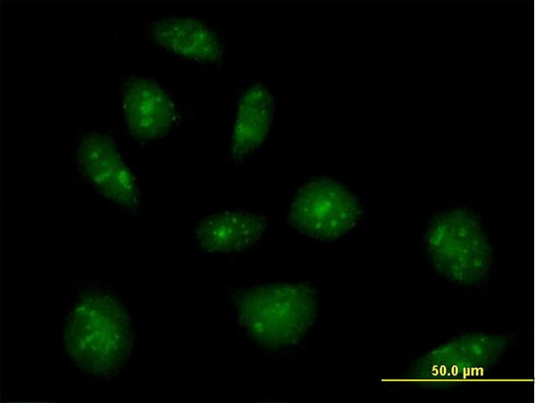 IL16 Antibody in Immunocytochemistry (ICC/IF)