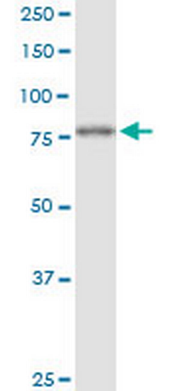 FOXK2 Antibody in Western Blot (WB)