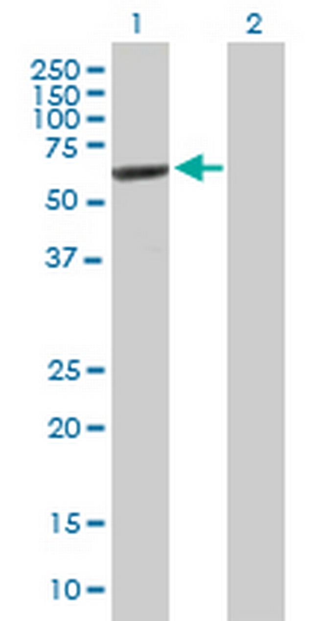 IMPDH2 Antibody in Western Blot (WB)