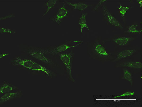 IMPDH2 Antibody in Immunocytochemistry (ICC/IF)