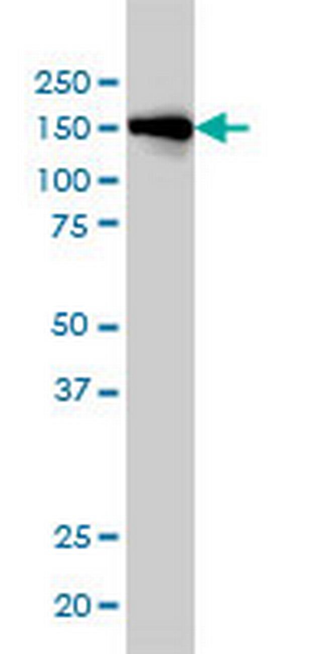 INPPL1 Antibody in Western Blot (WB)