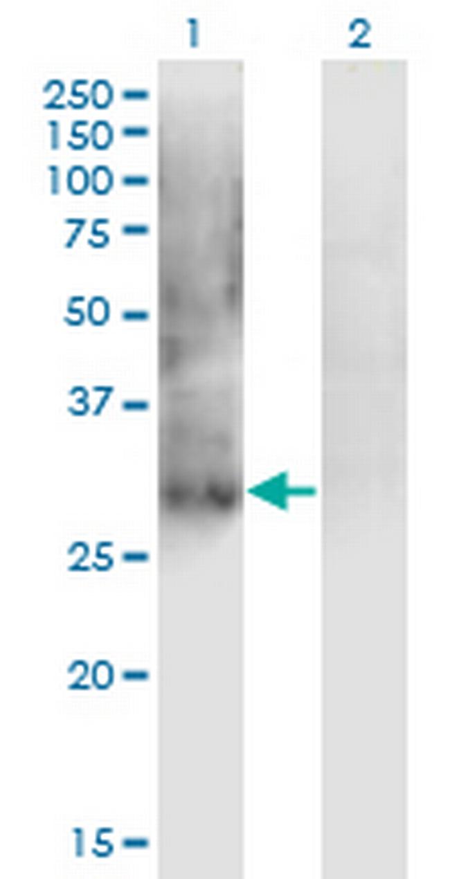 IPF1 Antibody in Western Blot (WB)