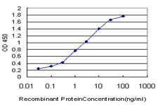 IRAK1 Antibody in ELISA (ELISA)