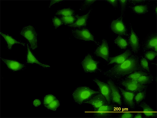 IRAK1 Antibody in Immunocytochemistry (ICC/IF)