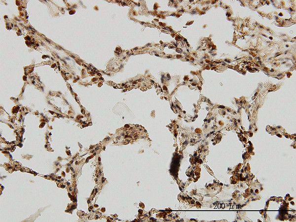 IRAK1 Antibody in Immunohistochemistry (Paraffin) (IHC (P))