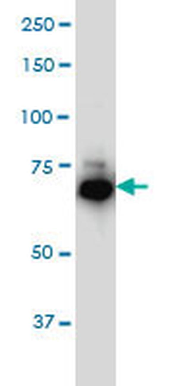 IRAK1 Antibody in Western Blot (WB)