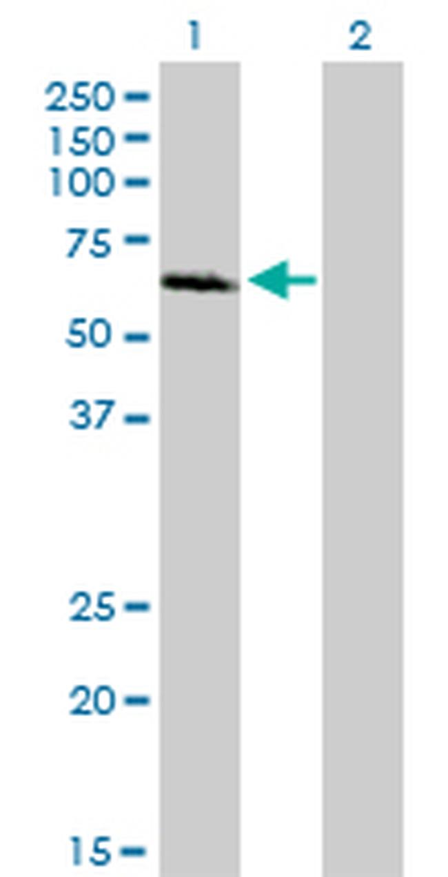 IRAK1 Antibody in Western Blot (WB)