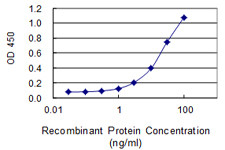 IRAK2 Antibody in ELISA (ELISA)