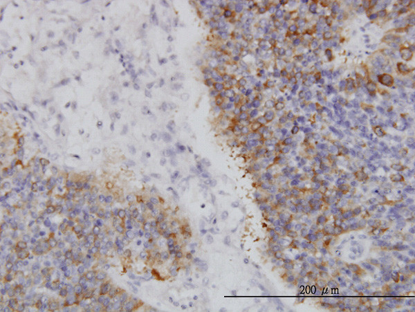 IRAK2 Antibody in Immunohistochemistry (Paraffin) (IHC (P))