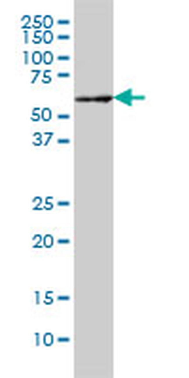 IRAK2 Antibody in Western Blot (WB)