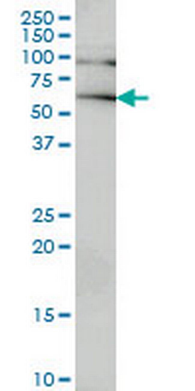 IRAK2 Antibody in Western Blot (WB)