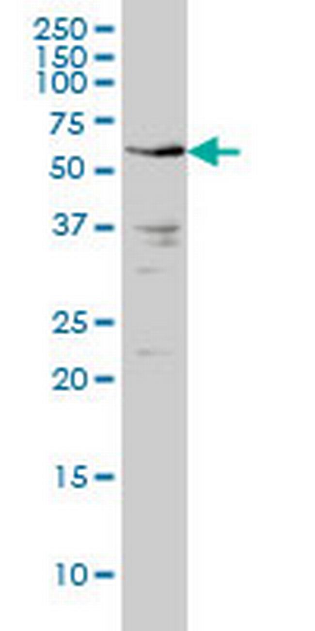 IRAK2 Antibody in Western Blot (WB)