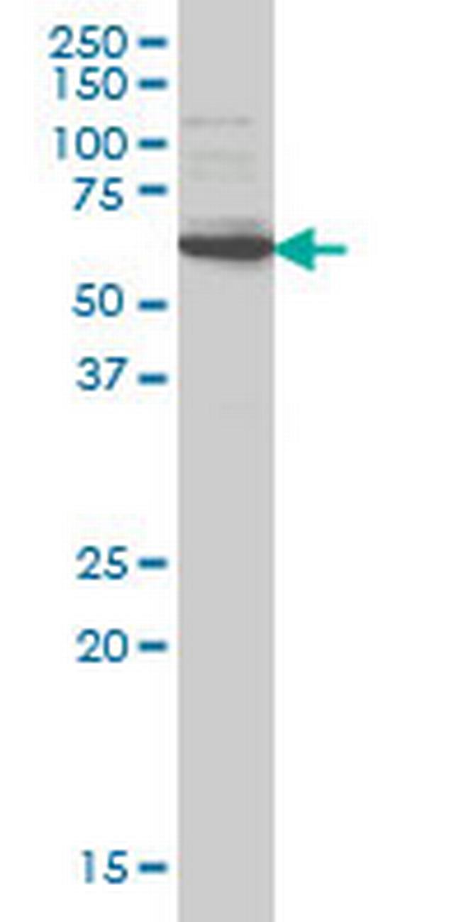 IRAK2 Antibody in Western Blot (WB)