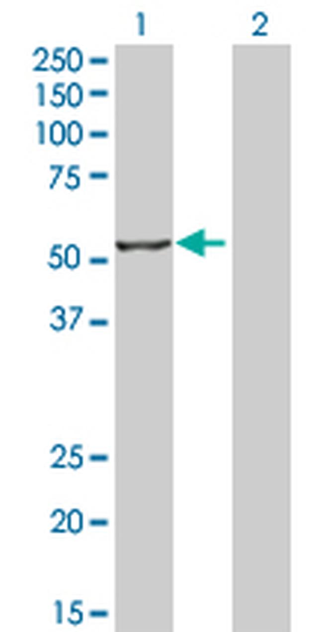 IRF4 Antibody in Western Blot (WB)