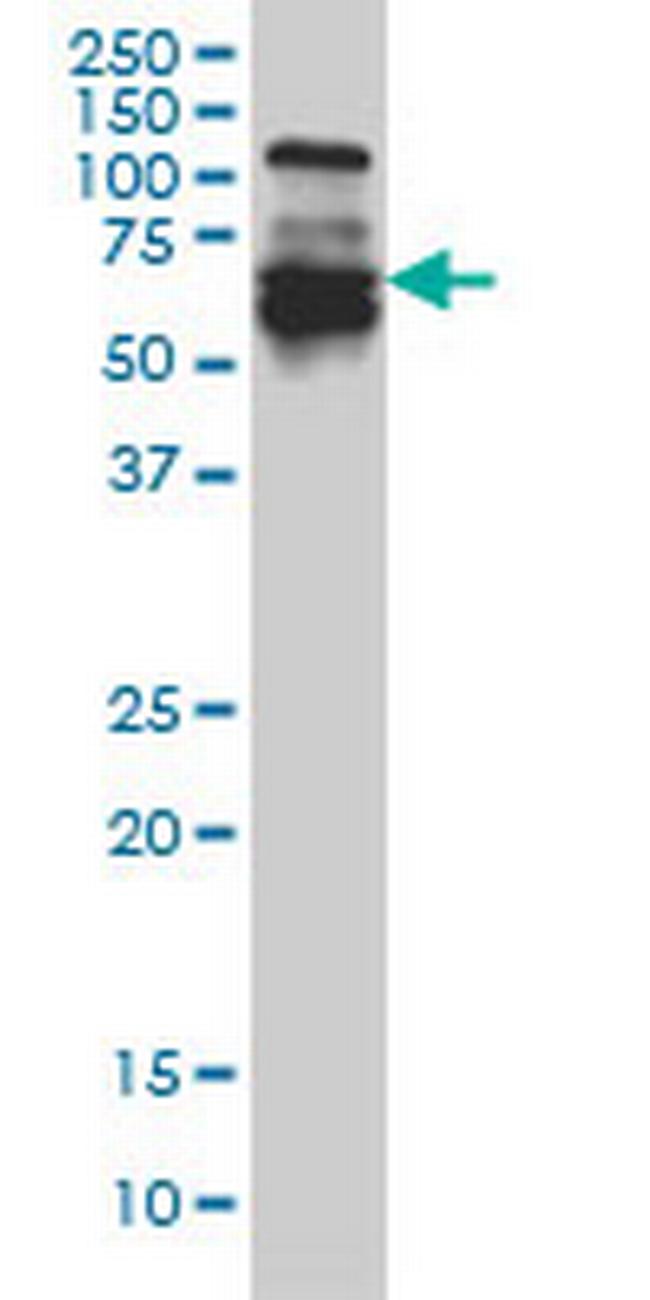 IRF5 Antibody in Western Blot (WB)