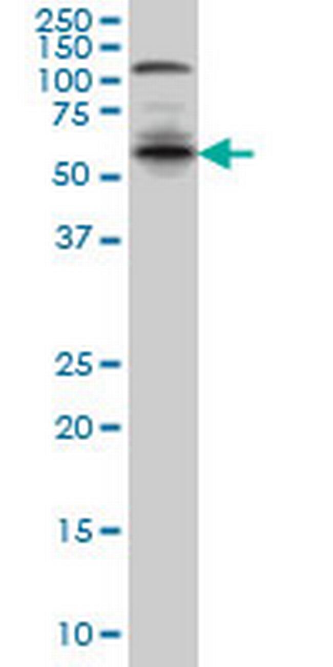 IRF5 Antibody in Western Blot (WB)