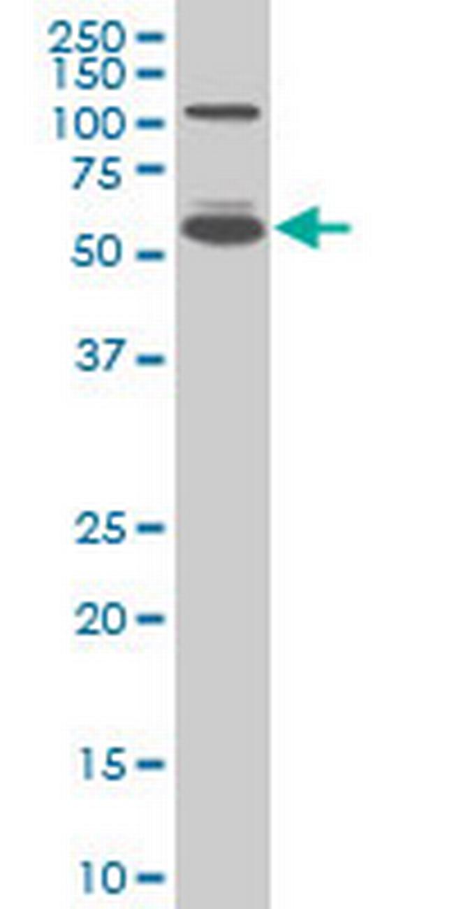 IRF5 Antibody in Western Blot (WB)