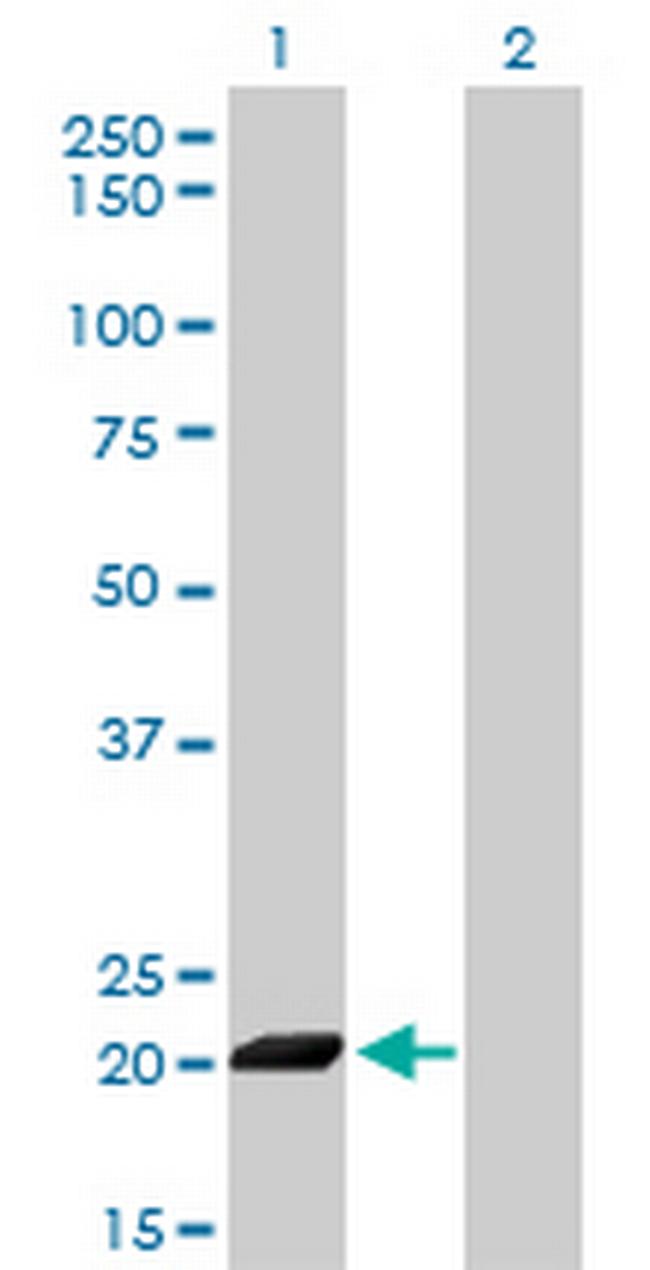 ISG20 Antibody in Western Blot (WB)