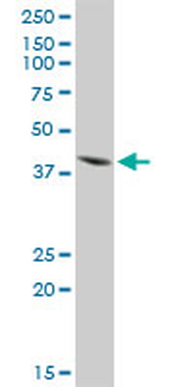 ISL1 Antibody in Western Blot (WB)