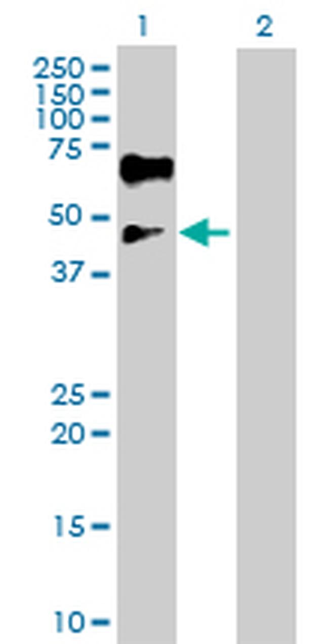 ISL1 Antibody in Western Blot (WB)