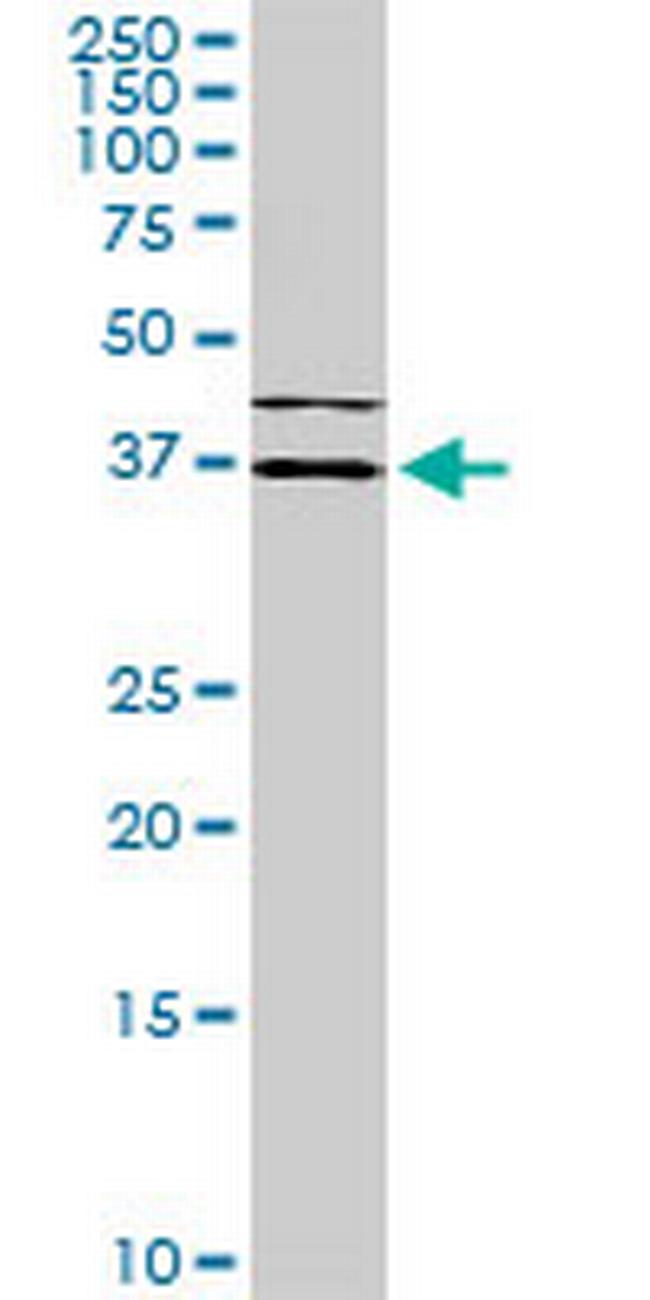 ISL1 Antibody in Western Blot (WB)