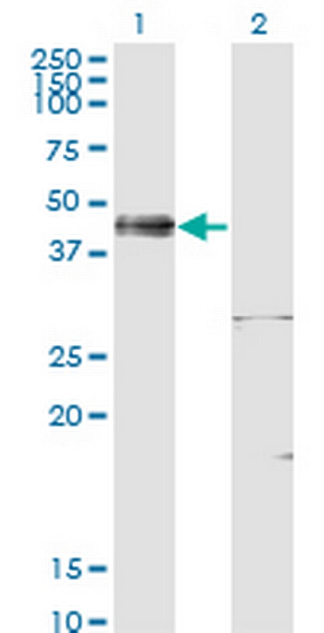 ISL1 Antibody in Western Blot (WB)