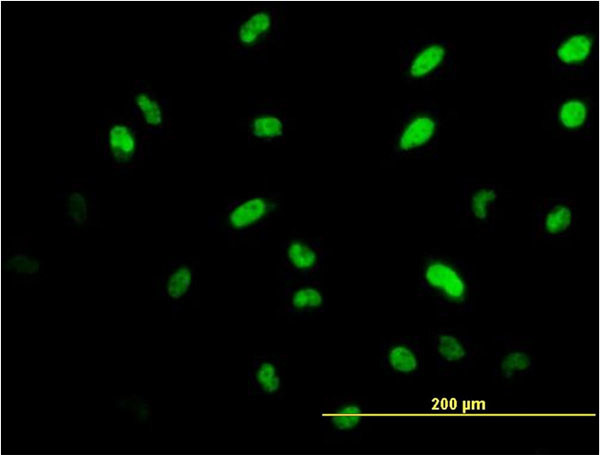 ISL1 Antibody in Immunocytochemistry (ICC/IF)