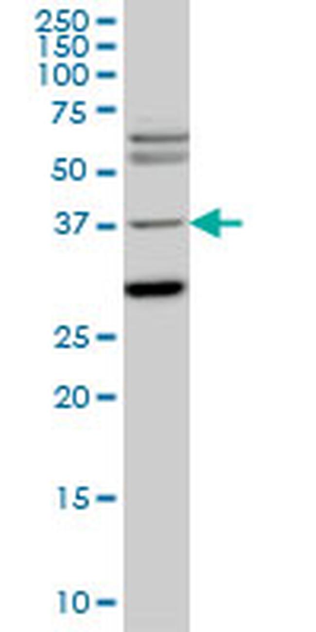 ISL1 Antibody in Western Blot (WB)