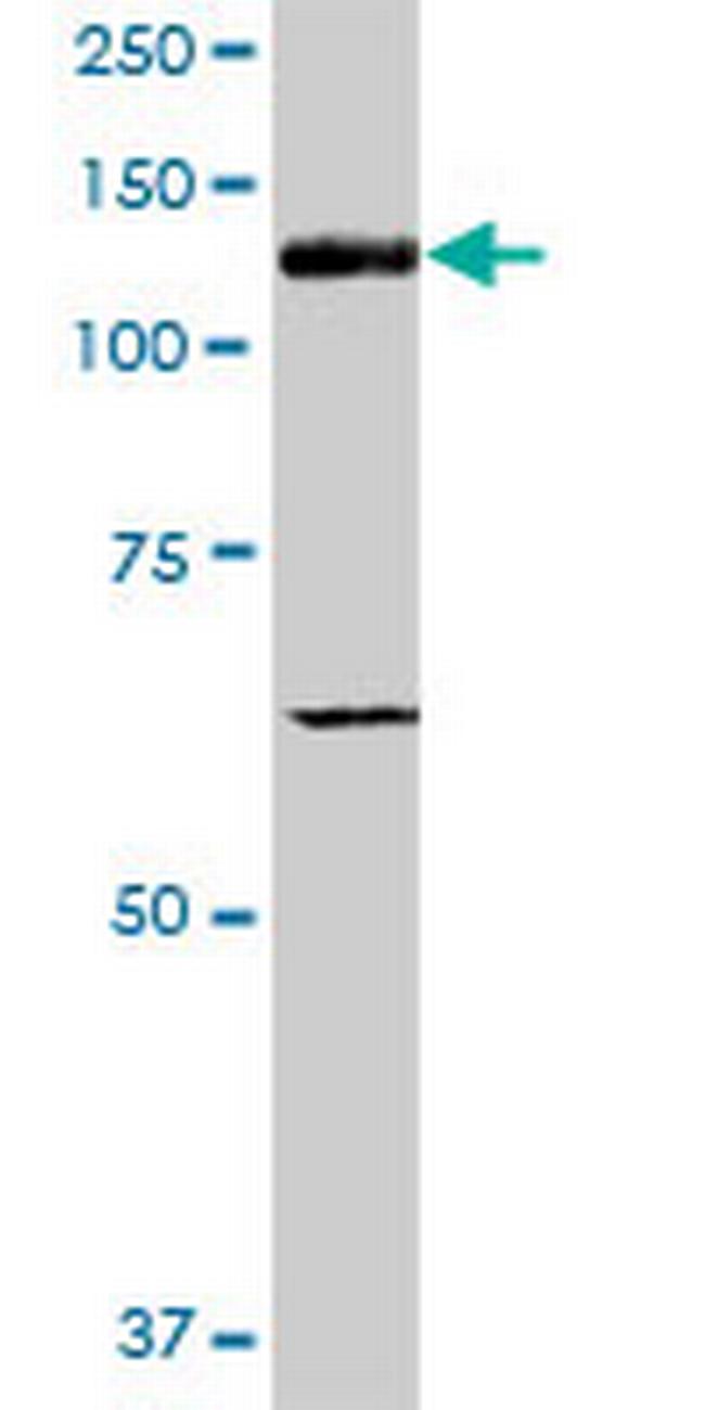 ITGAV Antibody in Western Blot (WB)