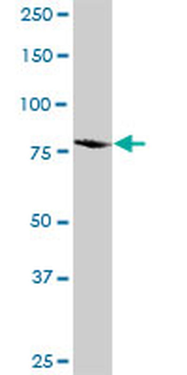 ITGB5 Antibody in Western Blot (WB)