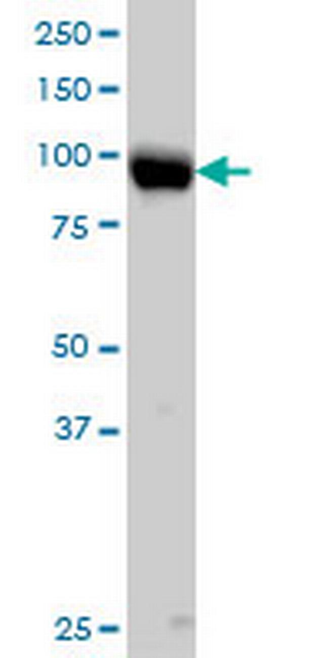 ITGB5 Antibody in Western Blot (WB)