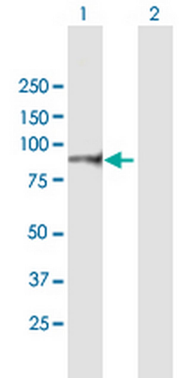 ITGB7 Antibody in Western Blot (WB)