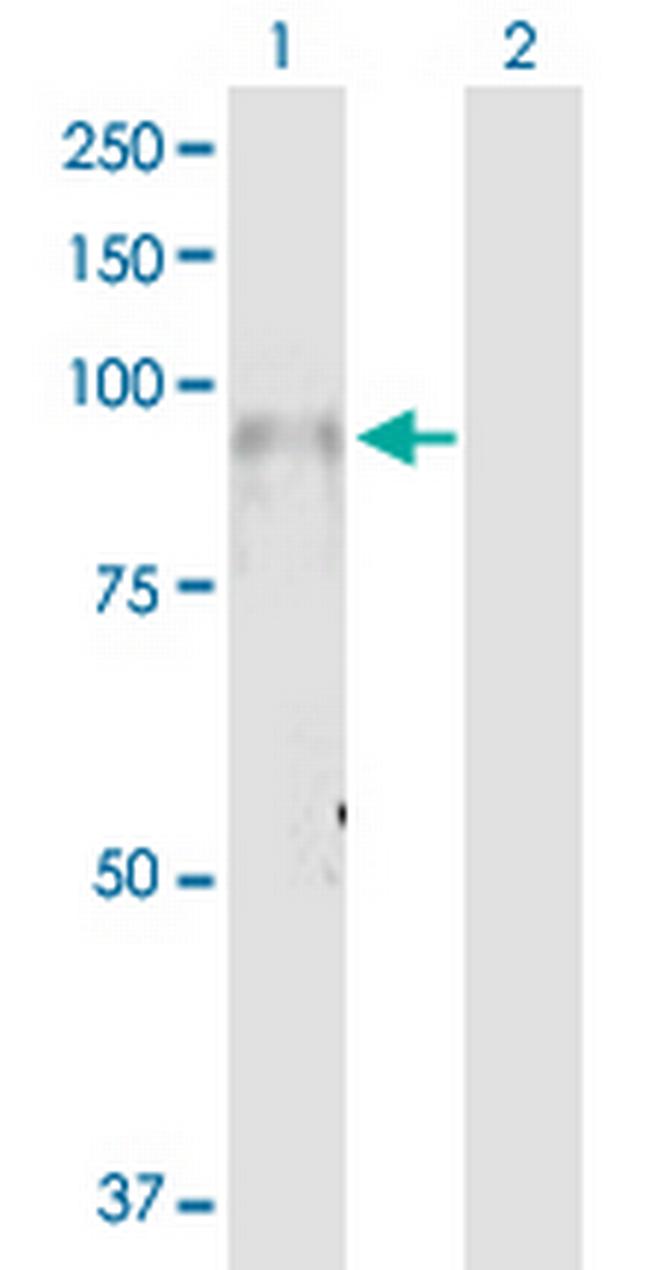 ITGB7 Antibody in Western Blot (WB)