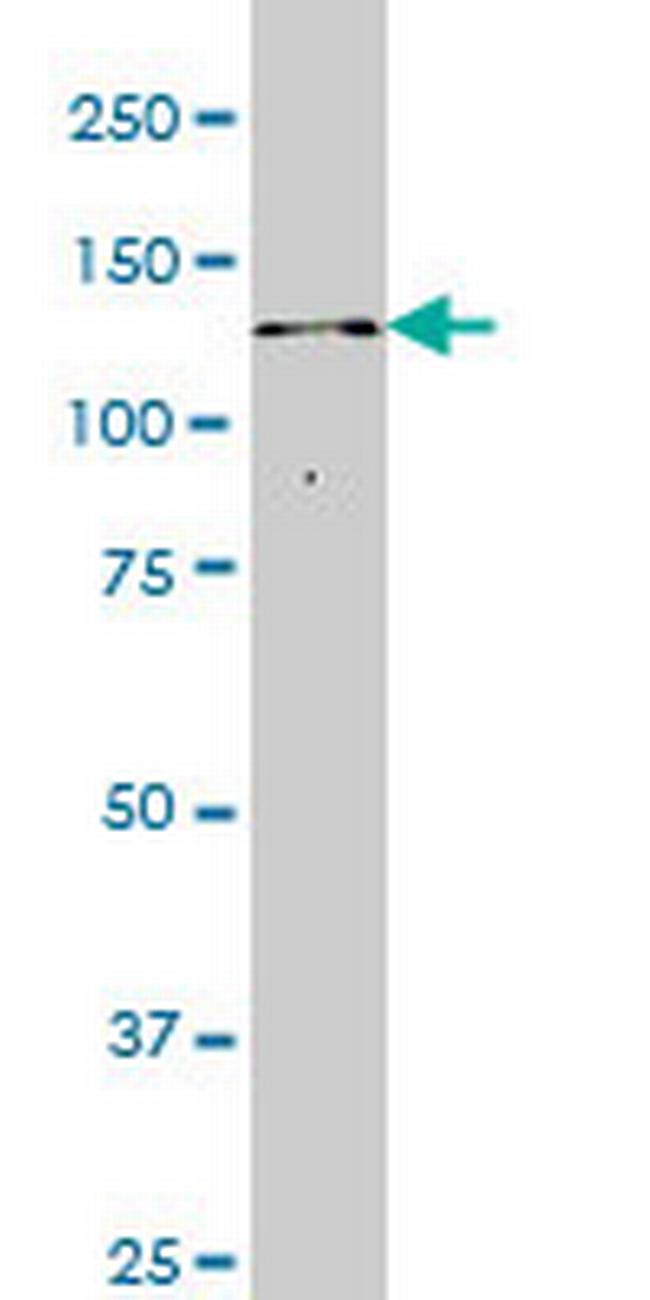 ITPKB Antibody in Western Blot (WB)