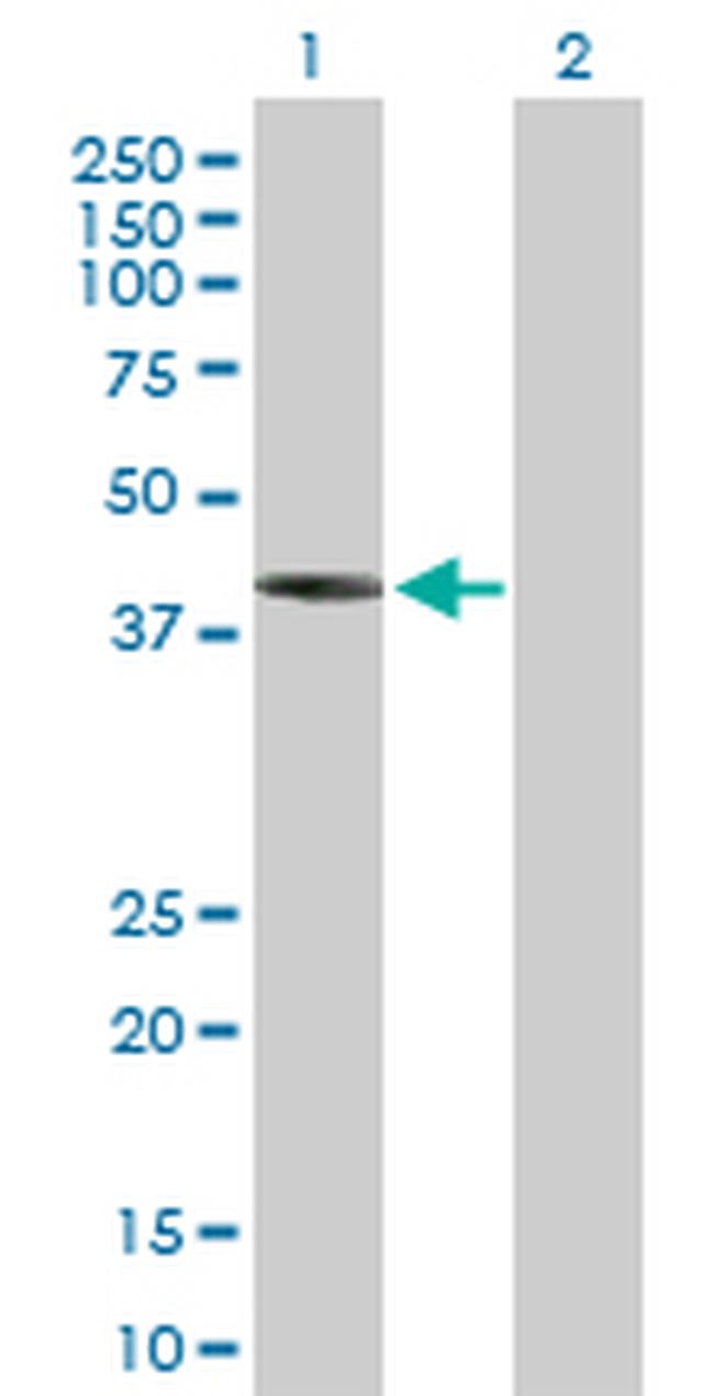 IVD Antibody in Western Blot (WB)