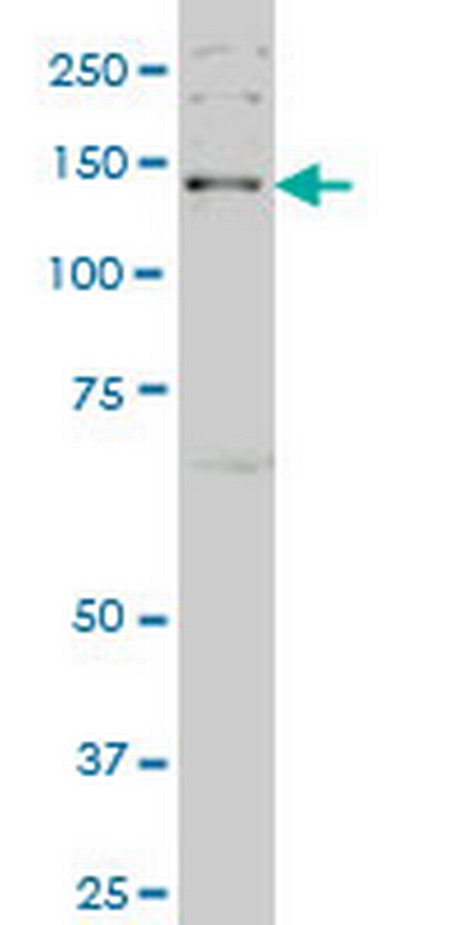 JAG2 Antibody in Western Blot (WB)