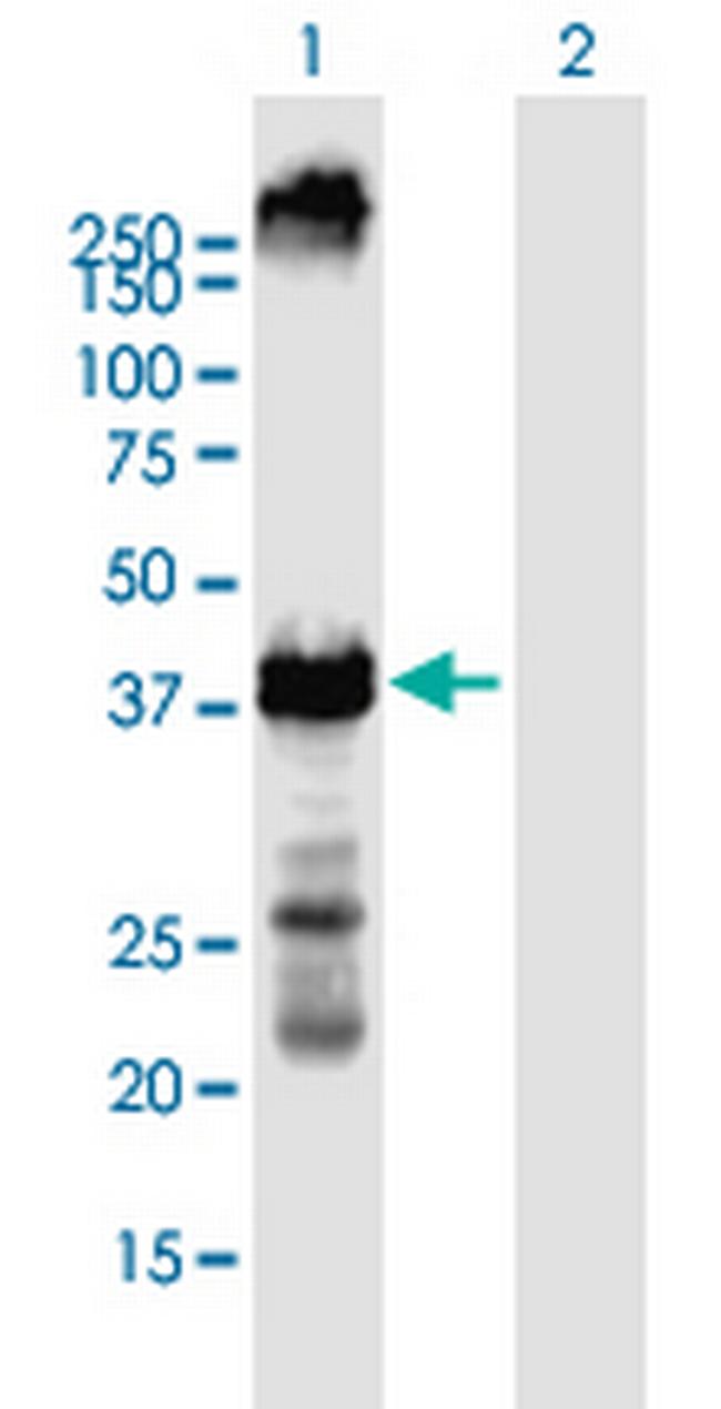 KCNA2 Antibody in Western Blot (WB)