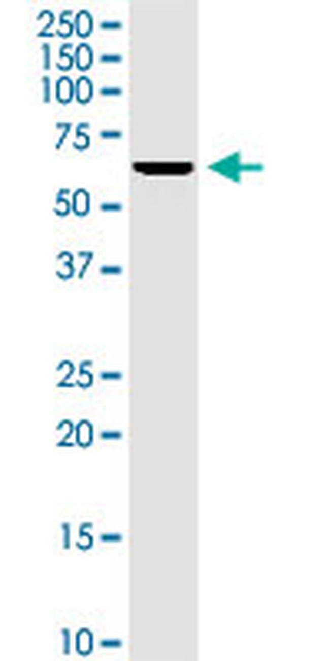 KCNA3 Antibody in Western Blot (WB)