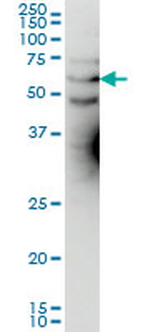 KCNA3 Antibody in Western Blot (WB)