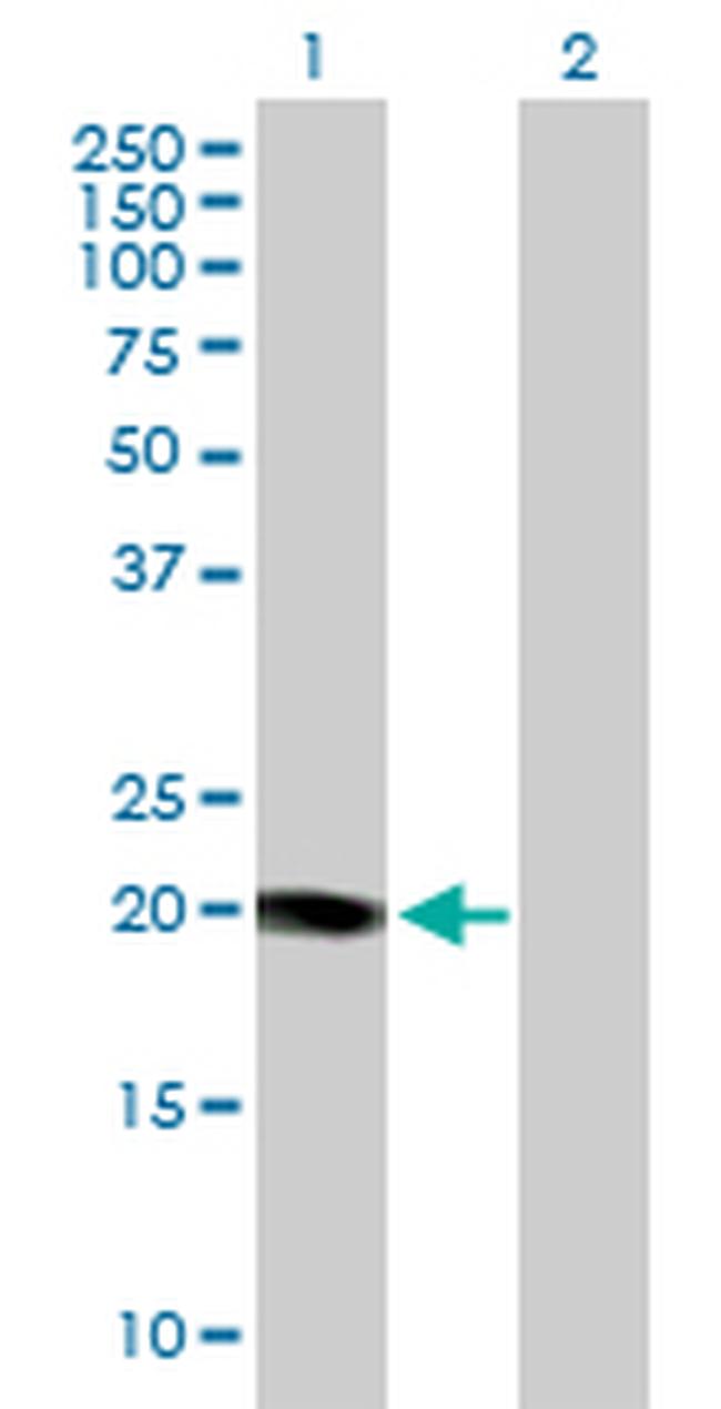 KCNE1 Antibody in Western Blot (WB)