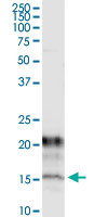 KCNE1 Antibody in Immunoprecipitation (IP)