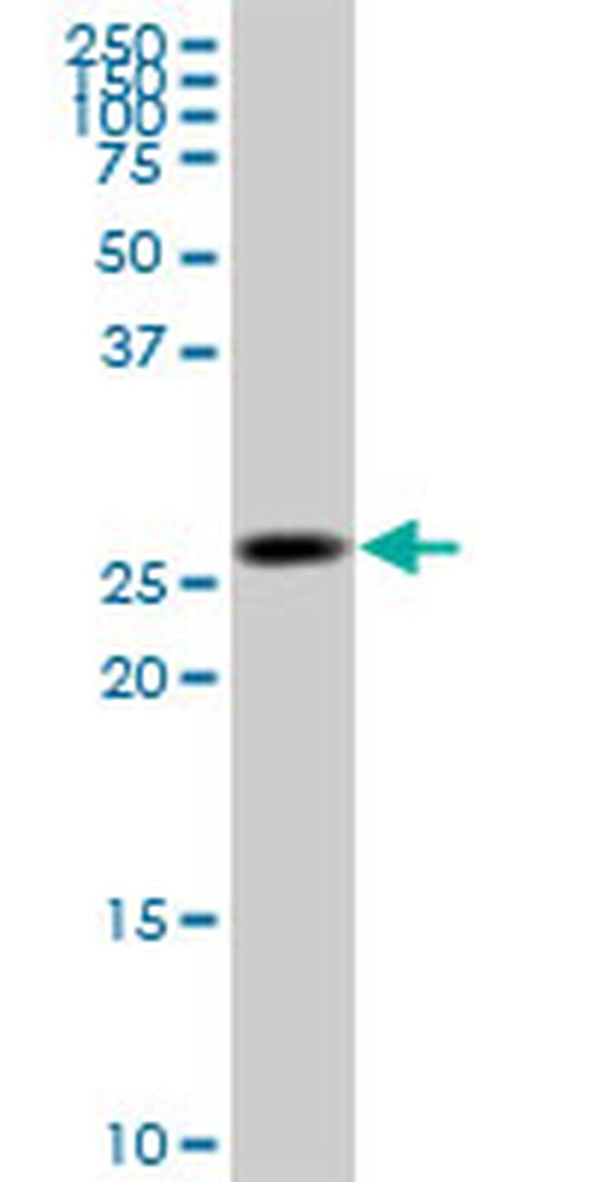 KHK Antibody in Western Blot (WB)