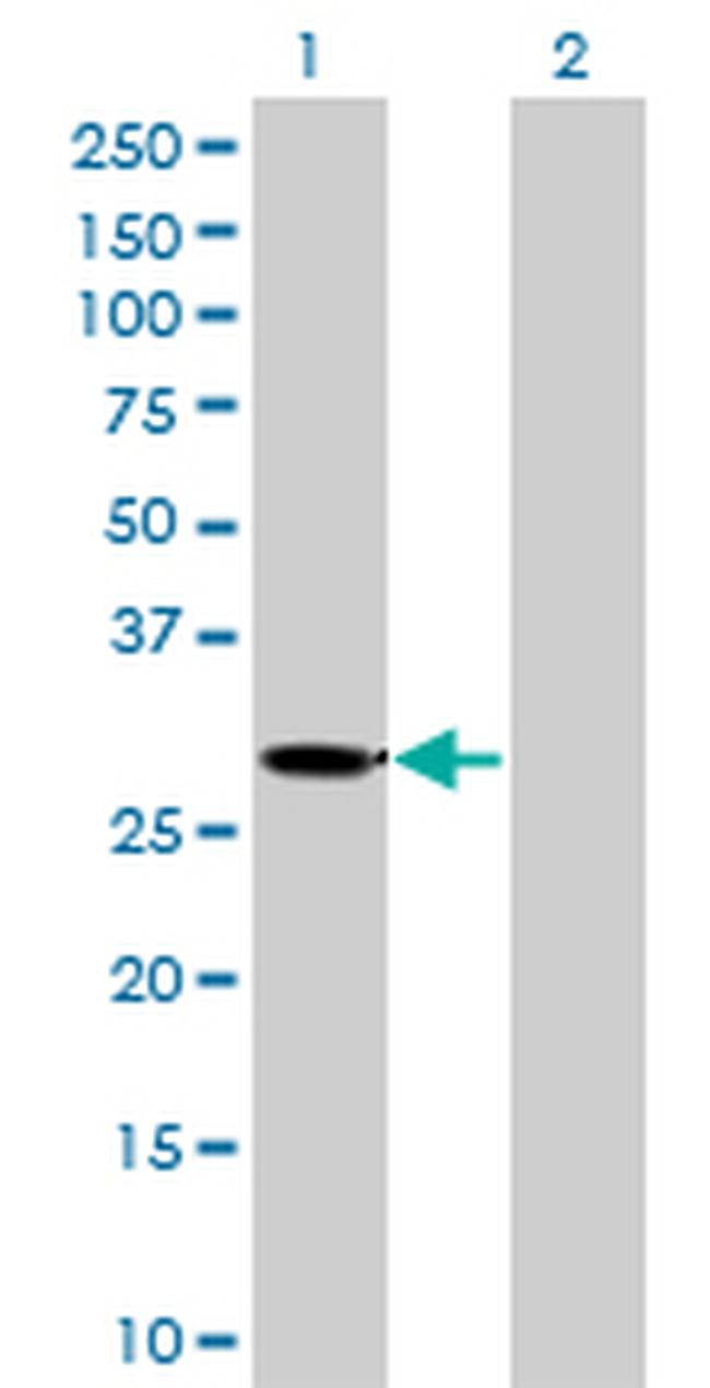 KHK Antibody in Western Blot (WB)