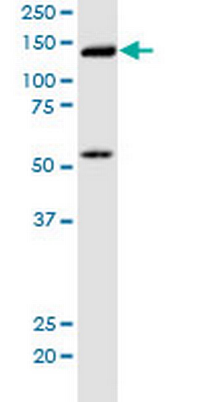 KIF5B Antibody in Western Blot (WB)