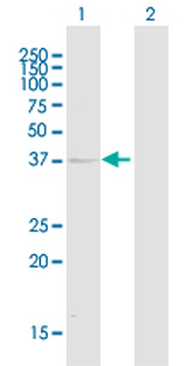 KIR2DL1 Antibody in Western Blot (WB)